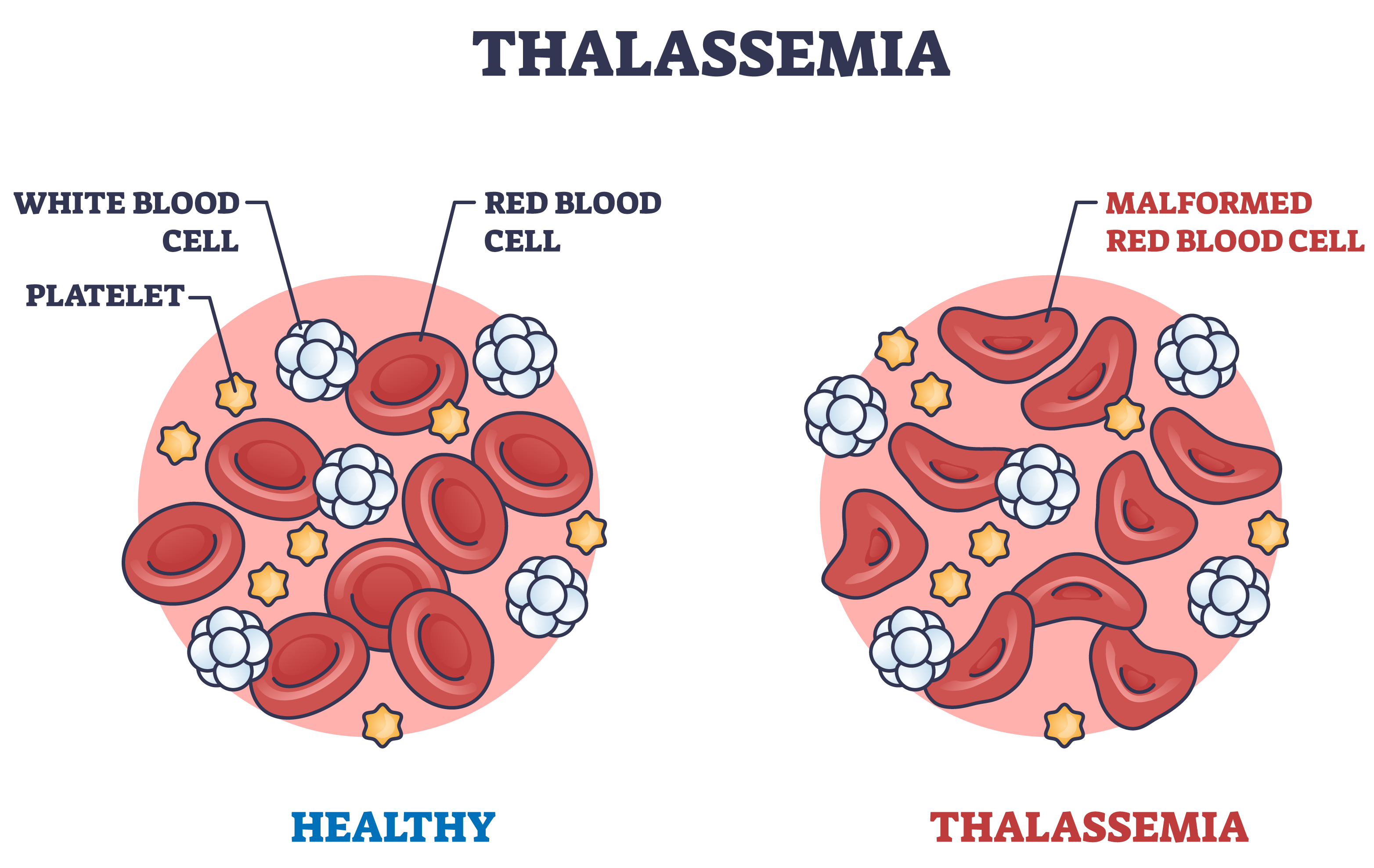 thalassemia red blood cells