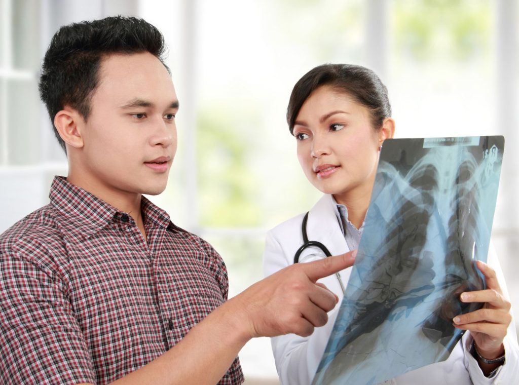 tuberculosis, TB, x-ray