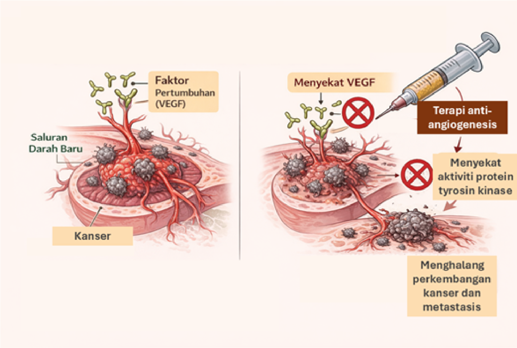 kanser, terapi angiogenesis