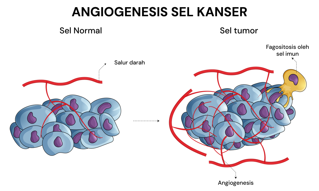 angiogenesis kanser