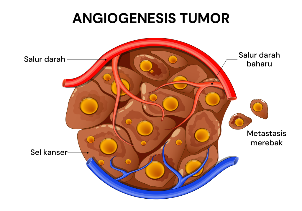 kanser, angiogenesis tumor